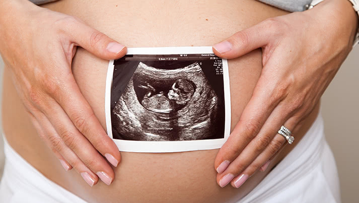 De leukste fotoproducten tijdens je zwangerschap